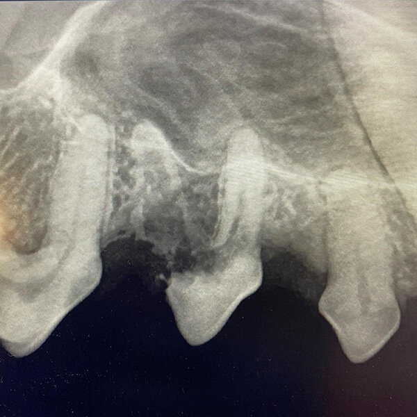 A diagnostic x-ray image